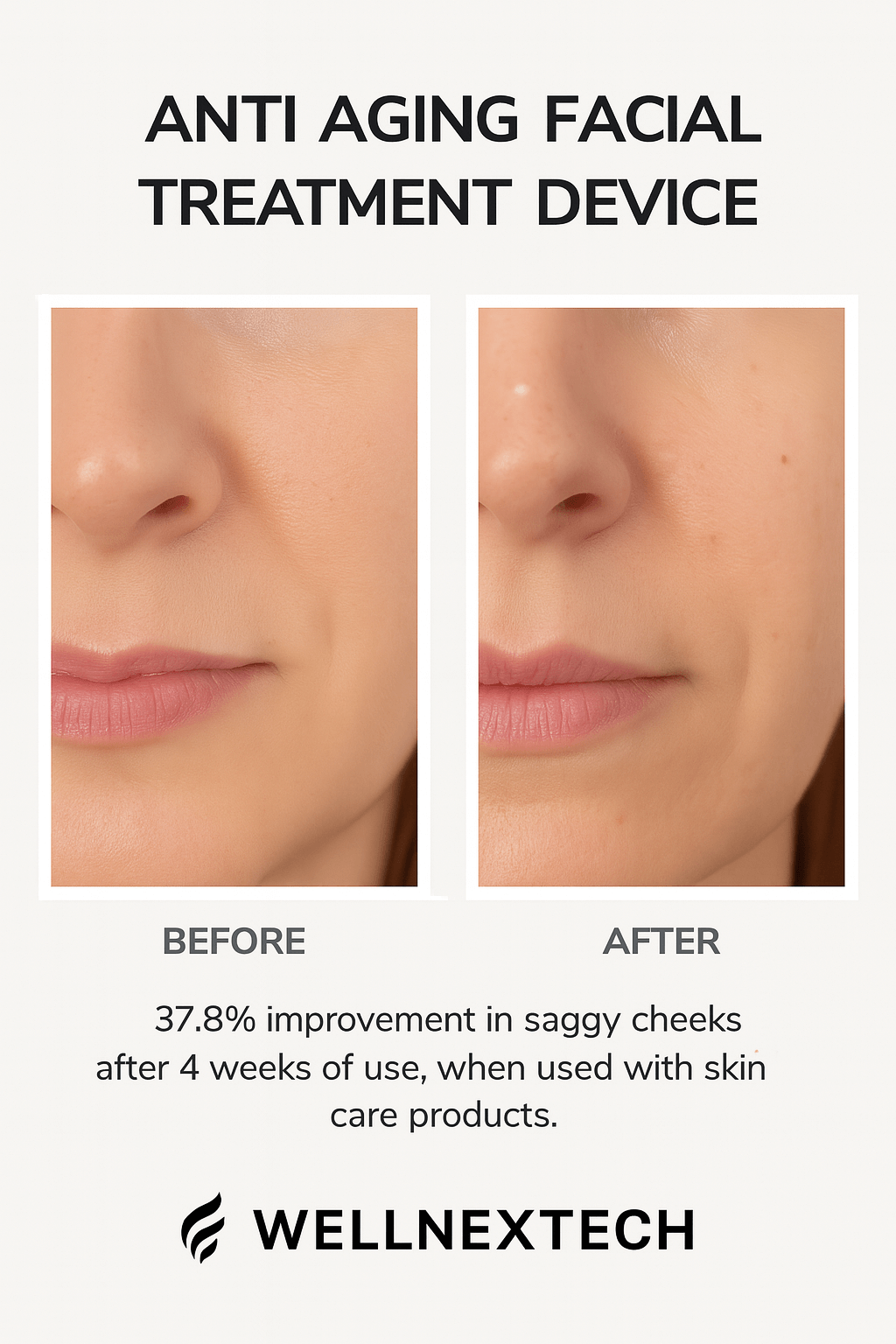 Before and after results of anti-aging facial treatment device showing improvement in saggy cheeks.